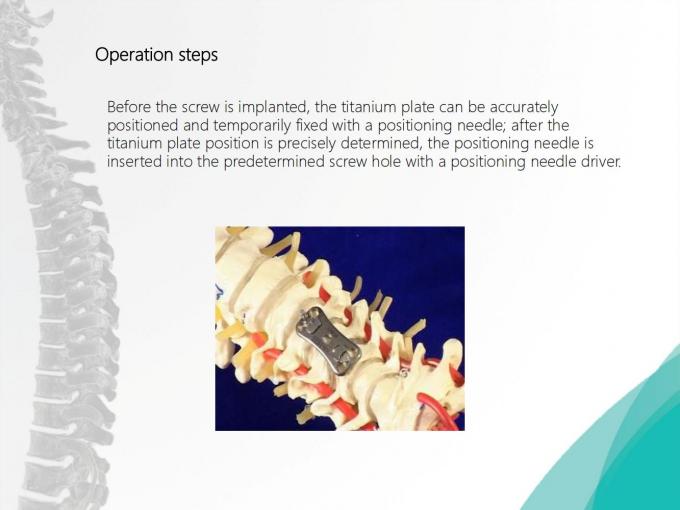 Spine Anterior Cervical Plate Titanium Cervical Plate Implant ...