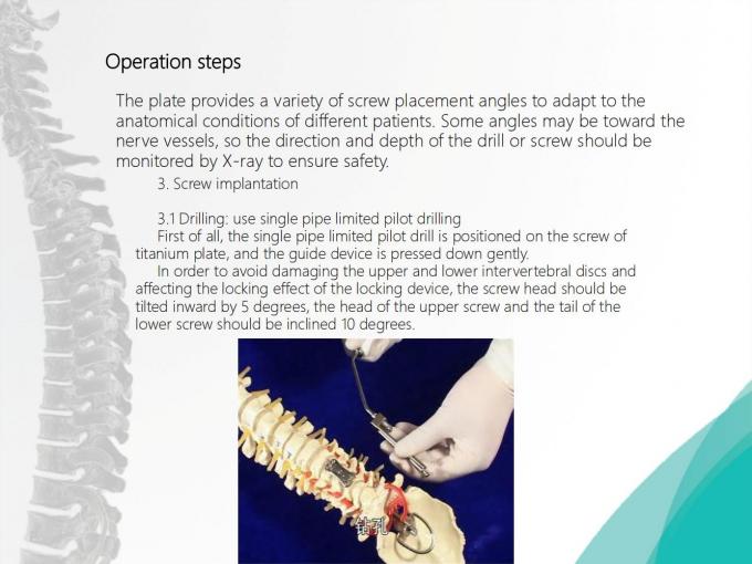 Spine Anterior Cervical Plate Titanium Cervical Plate Implant ...